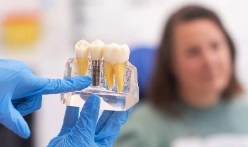 Dental Implants Phoenix